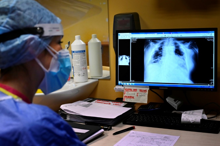  TB firmly on the rise after years of decline: WHO